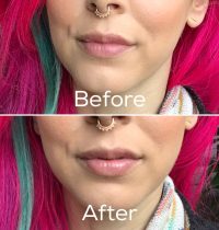 Juvalips Natural Lip Plumper – Does It Work!?